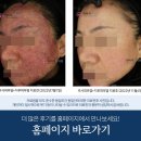 주사피부염스테로이드 홍조 차도가 없거나 더 심해졌다면 이미지