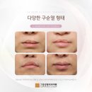 그림성형외과의원 네이버블로그