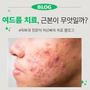 청담포워드피부과의원 네이버블로그