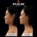 방배중앙로23길 42-3 | 대구 수성구 예쁘디온에서 받은 '시그니처 미세전류 괄사 관리' 후기