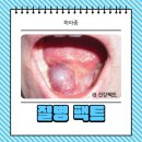 선이비인후과의원 | 하마종 자연치유 이비인후과, 수술 꼭 해야 할까?