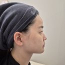 비전동 소로 3-21 | 비전동 에스테틱 / 아이리안뷰티 : 하이푸 관리 후기