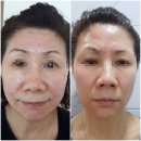 미라클인셀덤 | #포항 인셀덤 후기#누구신지?