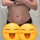 남천병원 사거리(7단지쪽) | 청담동 비만클리닉 엠스컬프 병원 복부 다이어트 후기