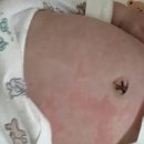 마곡휴연합의원 | [육아일기] 138~144일 (1.26~2.1) 트레이더스 마곡, 분유 알레르기 재발, HA분유 먹이기(매일유업 사랑...