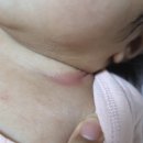 신생아 기저귀 발진 땀띠 간편하게 파우더 크림 사용 후기