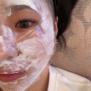 안산피부과 여드름 흉터치료 후기｜오를주사 후기
