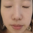 창원피부관리 라우라에스테틱 얼굴 윤곽관리 후기