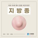 시대병원 | 안양 지방종 병원, 몸에 생긴 말랑한 혹 자꾸 커진다면?