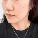 신논현역 조아성형외과 PRP 손주사 + 큐어젯 후기, 피부 속건조 채우고 온 날