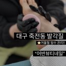 대구 죽전동 발각질 어반뷰티네일 패디플래닝 시술 후기