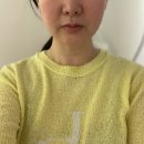 부산마이크로병원 | 부산 온다리프팅 | 내돈내산 10일차 후기