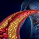 에스티바이오 이미지