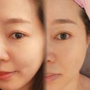 씨유 야탑아델파크점 | 올가드림뷰티 야탑아델파크점 분당 물광피부관리 찐 후기
