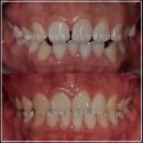 삐뚤한이바르게치과교정과치과의원 이미지