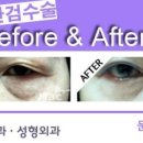 청담진성형외과피부과의원 이미지