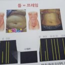 하면이뻐 이미지
