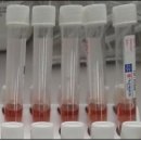 아산제약㈜ 이미지