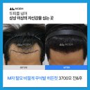 강남고려병원 | 강남역탈모병원 잘 됐다는 후기 뒤에 숨겨진 것