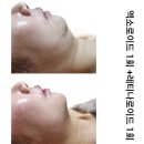 레티나메디칼 이미지