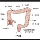 조치원 한의원 오늘은 변비에 대해서 알아볼까요? 이미지