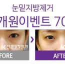 더코성형외과 이미지