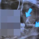 인천사랑니구강악안면외과치과의원 이미지