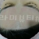 라미헤어라인