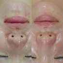 임채연&팜스스파 이미지