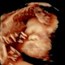 사랑방한의원 | [임신출산기록, 28W] 28주 임산부 일상, 뒤뚱뒤뚱 펭귄이 되어가는 중