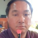 미현 인셀덤