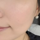 효소엔자임