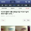 &#39;티아라 탈퇴&#39; 아름 신병설 언급 &#34;이모가 낳지 못한 아들이 내게...&#34;(사진깜놀주의) 이미지