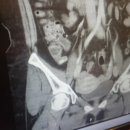 선두외과의원 | 맹장수술 노원역 선두외과 수술 후기