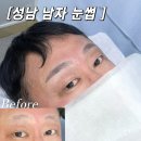 중원-121 | 아예없는 성남 남자 눈썹문신 시술 후기