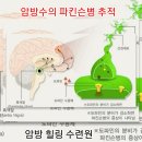 암방수의 파킨슨병 추적 이미지