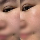 진짜 안 떨어짐! 밀착력 좋은 고보습 마스크팩 영셀로지 로살리스 후기