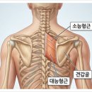 날개뼈 사이 통증,능형근(능형근 통증이 두통까지 이어진 이유, 재활의학과 치료 후기)