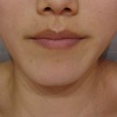 The피부빛나 네이버블로그