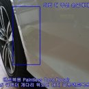 크라운덴트 이미지