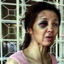 Woman hurt in snatch theft bid 이미지