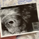 온산부인과의원 이미지