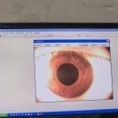 지성한의원 | 난임으로 유명한 지성한의원 후기 (방문, 한약 복용 후기)