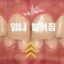 함박미소치과 이미지