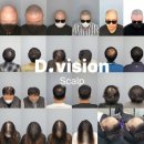 디비전 스칼프 이미지