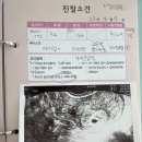 GS당진행복점 | 임신 5주차 진료 후기 | 아기집 확인하고 국민행복카드 발급까지