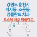 강원도 춘천시 석사동, 조운동, 약사명동 임플란트 치과 종류별 특징 알아보기