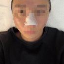 아르떼01 | 목동 여드름 피부관리 목동역 남성케어 추천 '아르떼01' 후기