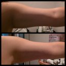 조형과 운동 | 청라피부관리 더스파엣오아시스 조형근막테라피 후기