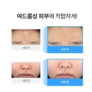 클레어스 | 여드름 진정 EGF 에센스 추천 디어클레어스 블루 진정세럼 내돈내산 후기,진정 세럼 추천